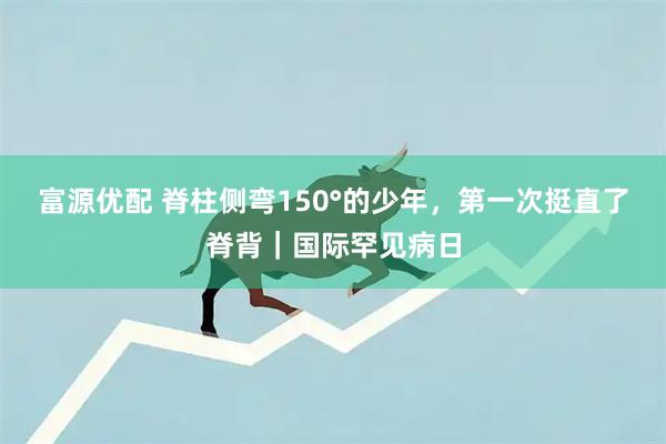 富源优配 脊柱侧弯150°的少年,第一次挺直了脊背|国际罕见病日